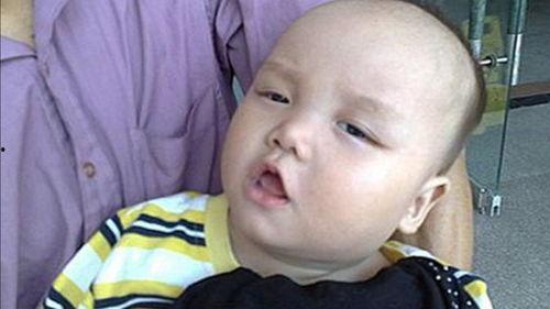 吃瓜舌头疼多久,揭秘吃瓜后的短暂不适